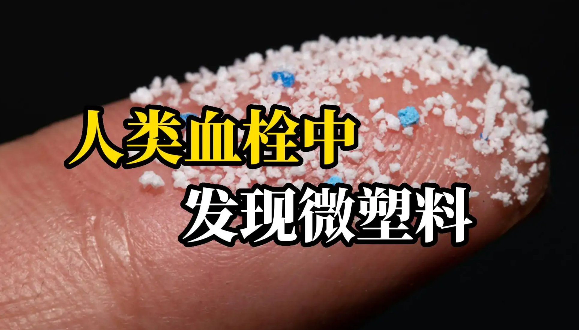 震驚！人（rén）類血栓（shuān）中首次發現微塑料！